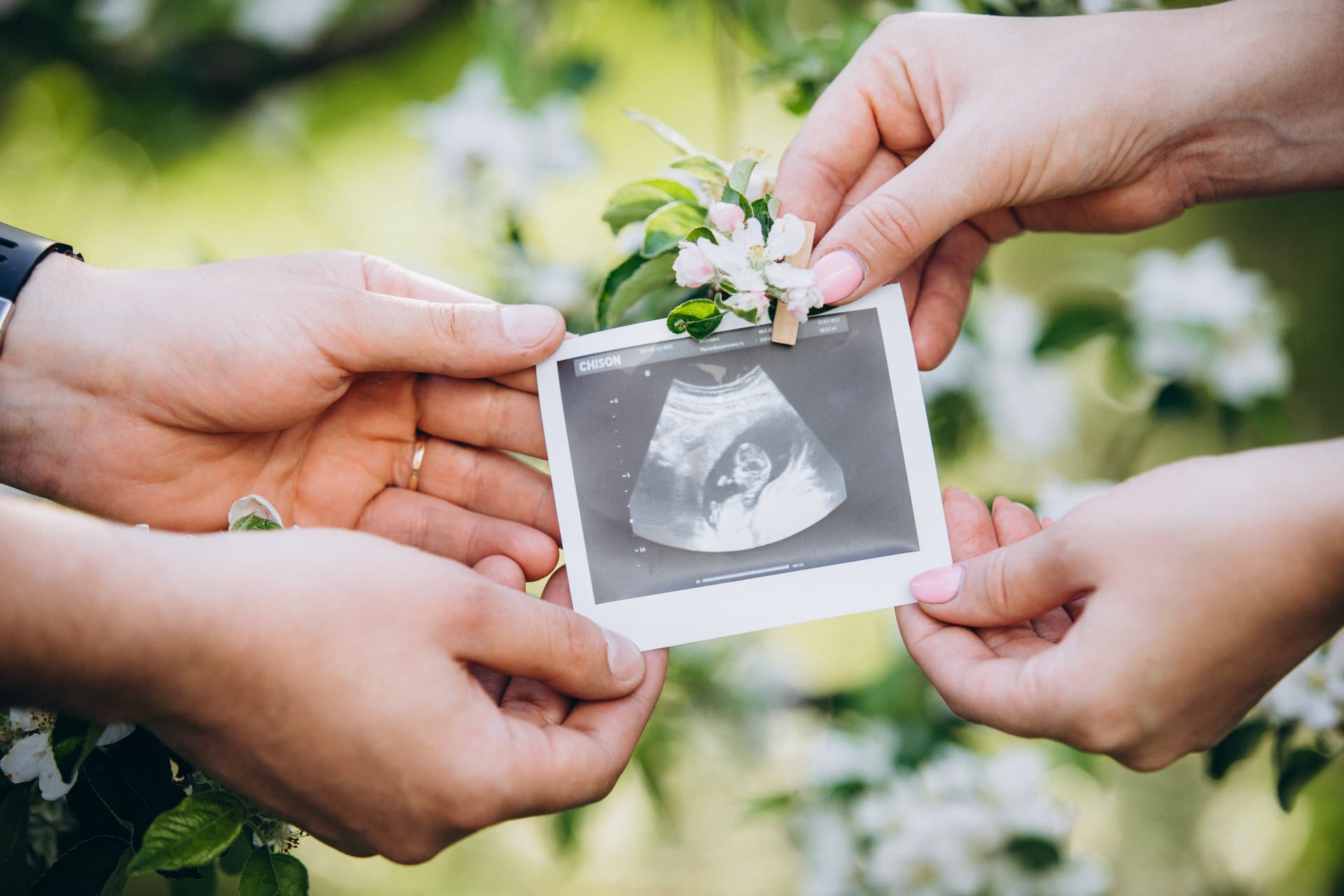 Hands holding an ultrasound sonogram photo in a garden
