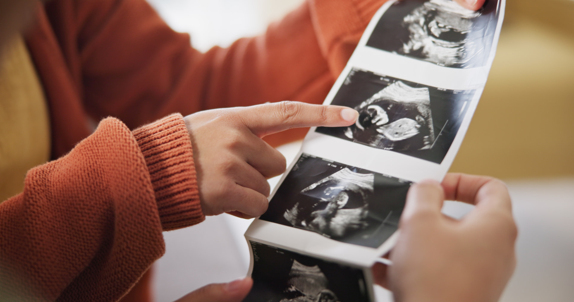 Hands holding ultrasound sonogram photos after donor egg transfer